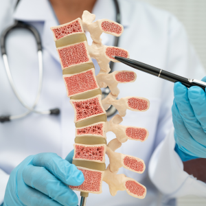 Jangan Abaikan Nyeri Tulang, Bisa Jadi Gejala Kanker